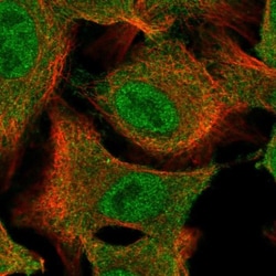 CHIP/STUB1 Antibody, Novus Biologicals:Antibodies:Primary Antibodies